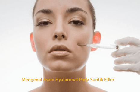 Mengenal Asam Hyaluronat Pada Suntik Filler