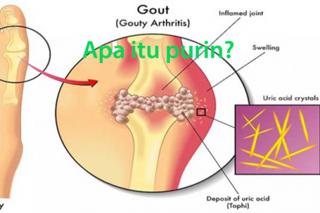 Apa Itu Purin